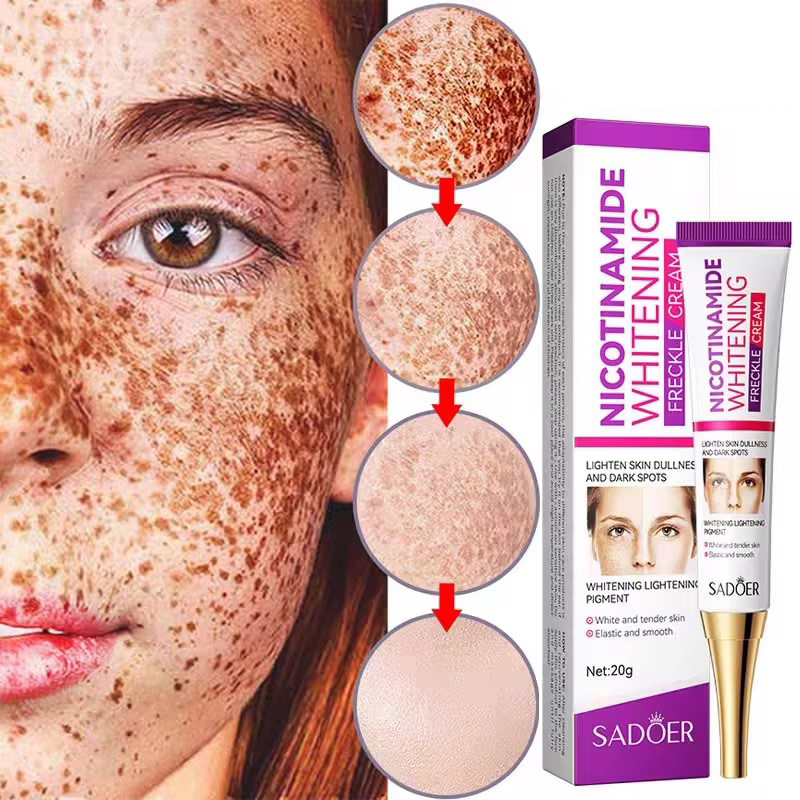 Kem nám tàn nhang kem dưỡng trắng da mặt 20g Niacinamide làm trắng Loại bỏ hiệu quả nám đốm đồi mồi và đốm đen