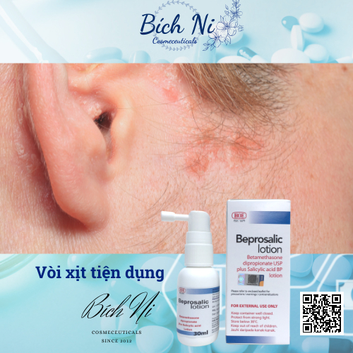 Beprosalic Lotion 30 ml chai xịt  giảm Chàm, Vảy nến, Nấm da đầu - Mỹ phẩm chính hãng Hoe.