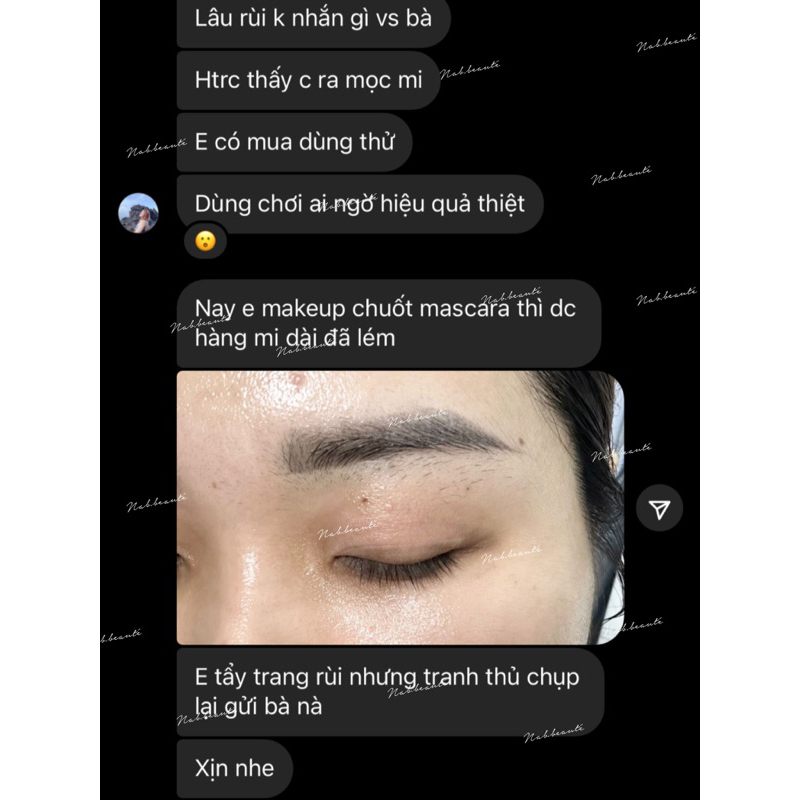 Serum Mọc Mi/Mày có Redensyl giúp hiệu quả rõ