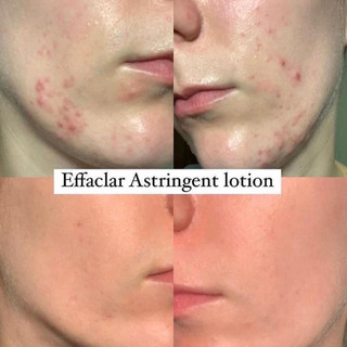 NƯỚC HOA HỒNG LA ROCHE-POSAY