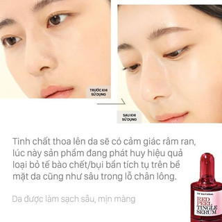 Tinh chất Red Peel Tingle Serum 10ml ls
