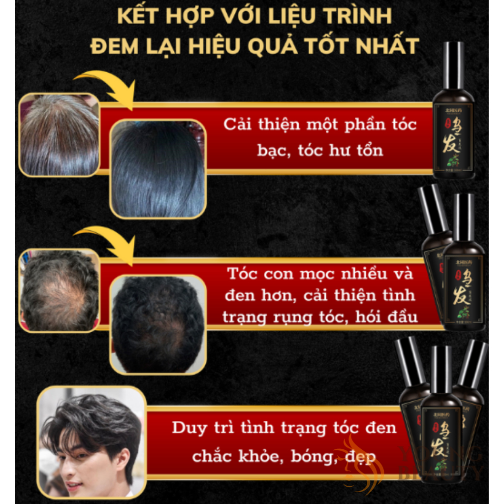 Tinh chất thảo dược đen tóc Bai Kon - Xịt đen tóc Bai Kon cải thiện tóc bạc, giúp tóc đen bóng chắc khỏe - YOUNG BEAUTY