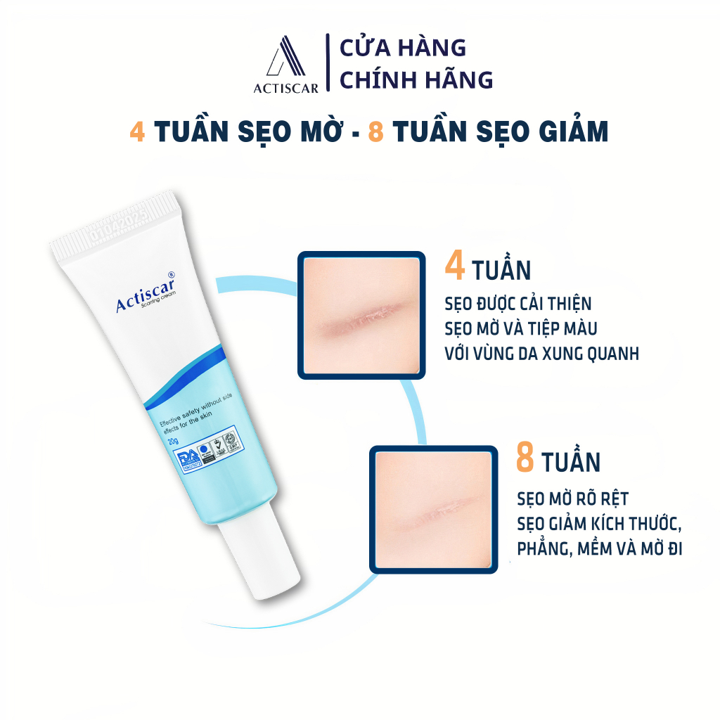 Kem Xóa Sẹo Actiscar, Làm mờ Sẹo Lồi, lấp đầy sẹo Lõm Rỗ 20g