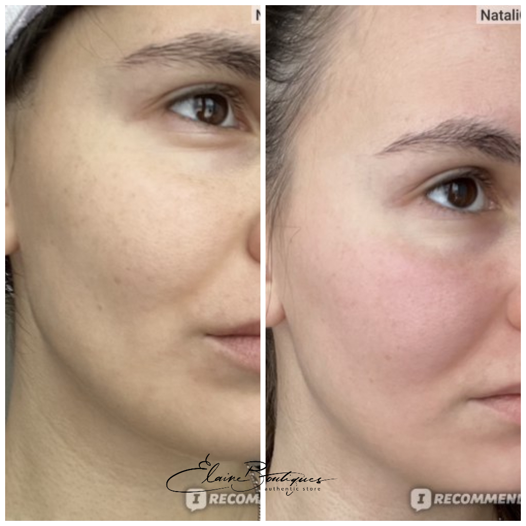 Tinh chất chống lão hóa, dịu da SUR.MEDIC+ AZULENE SMOOTHING PEPTIDE AMPOULE