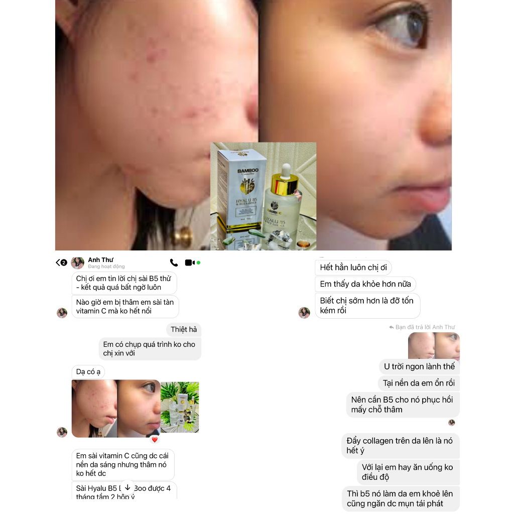 ⭐Mẫu mới 2023⭐Serum gạo B5 Bamboo siêu phục hồi da