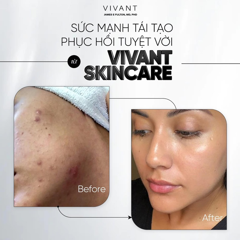 Tinh Chất Dưỡng Chống Lão Hoá VIVANT Vitamin A Serum Mandelic Axit