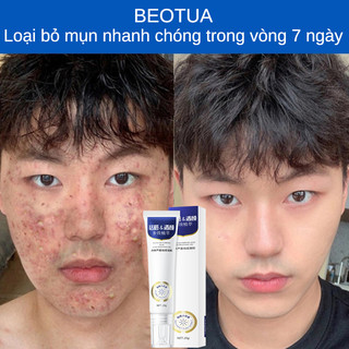 Kem chấm mụn tận gốc, Kem chấm mụn cấp tốc 20ml loại bỏ các loại mụn, mụn ẩn, mụn đầu đen, mụn ở tuổi dậy thì, ​loại bỏ