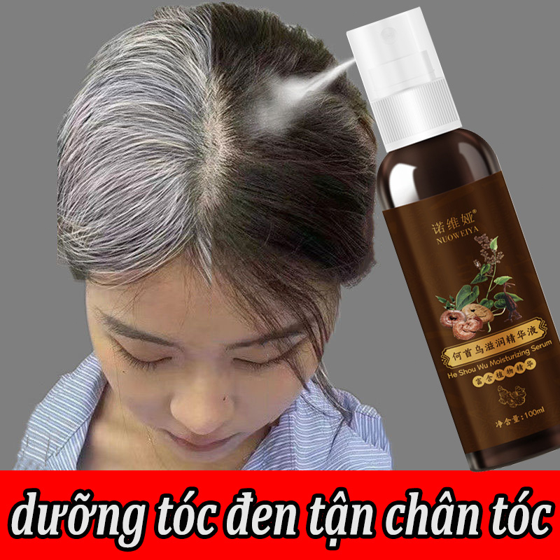 đen tóc xịt Xịt mọc tóc dầu xả 100ml Chiết xuất thực vật tự nhiên có hiệu quả tóc đen Tóc mọc Chống rụng tóc dưỡng tóc