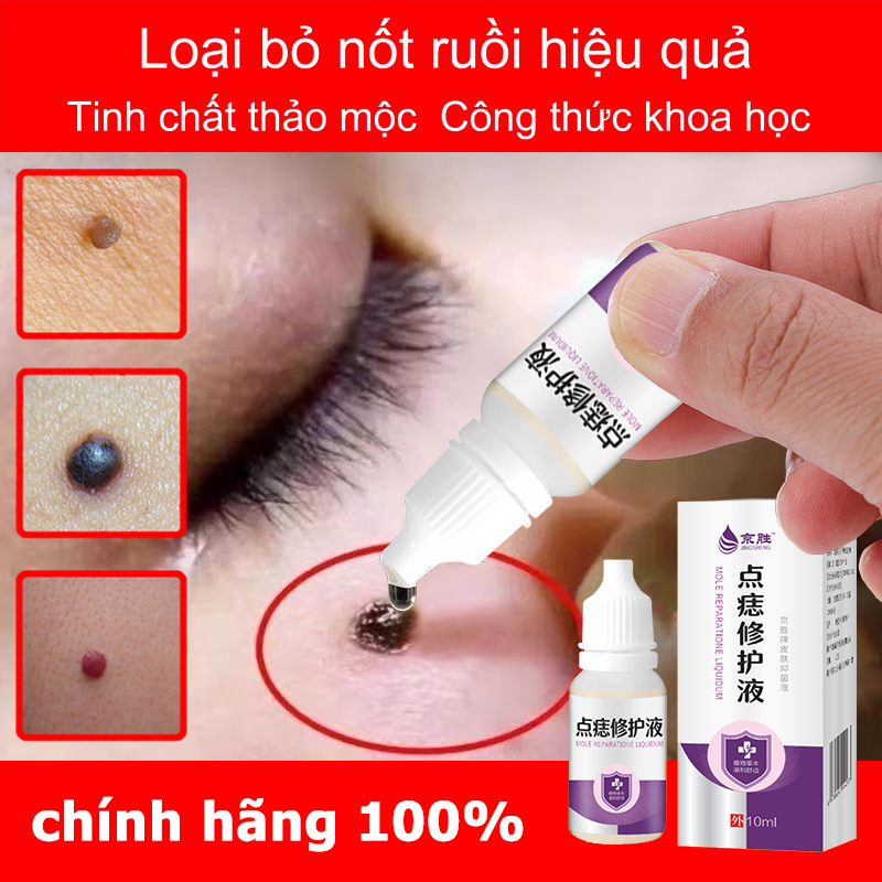 Dung dịch phục hồi xóa nốt ruồi10ml,Mụn ruồi đen/Mụn ruồi lồi/Mụn ruồi thịt Serum Loại Bỏ Nốt Ruồi Và Tàn Nhang Hiệu Quả