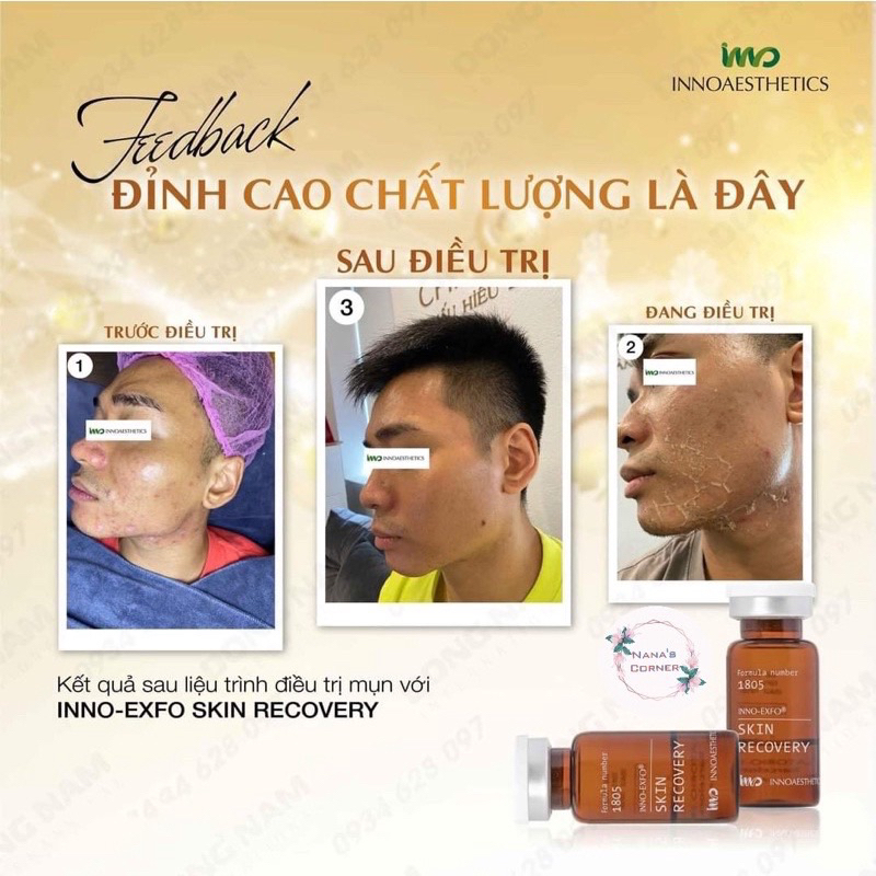 Tinh Chất Peel Cho Da Sẹo Rỗ T.C.AGE Innoaesthetics