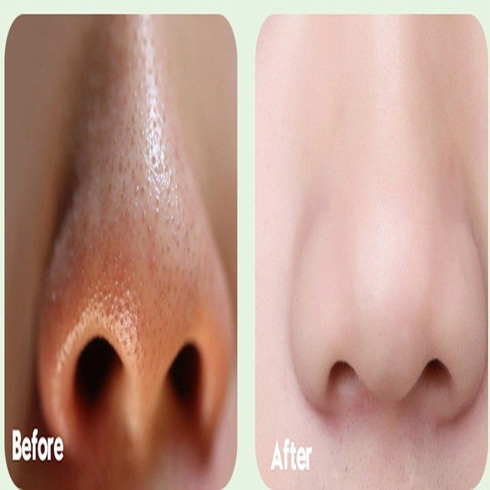 Gel Tẩy Tế Bào Chết Lô Hội Yinmei 100g