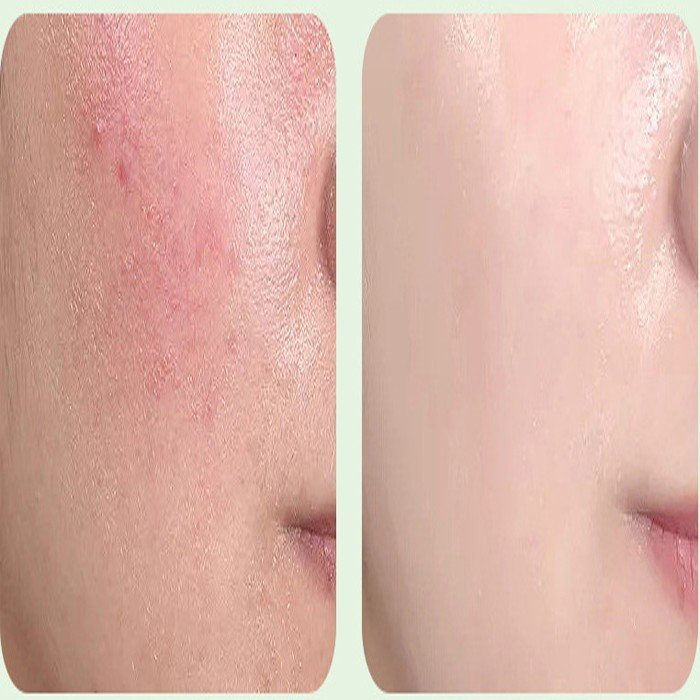 Gel Tẩy Tế Bào Chết Lô Hội Yinmei 100g