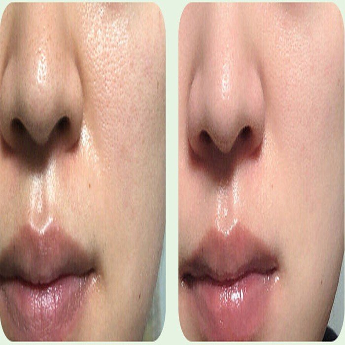 Gel Tẩy Tế Bào Chết Lô Hội Yinmei 100g