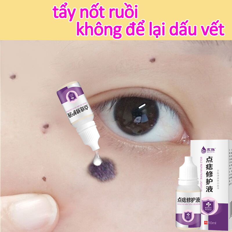 Tẩy nốt ruồi Kem Hỗ Trợ Giảm Mụn Cóc Nốt Ruồi Và Đốm Nâu Chính Hãng tàn nhang mụn cóc mụn thịt