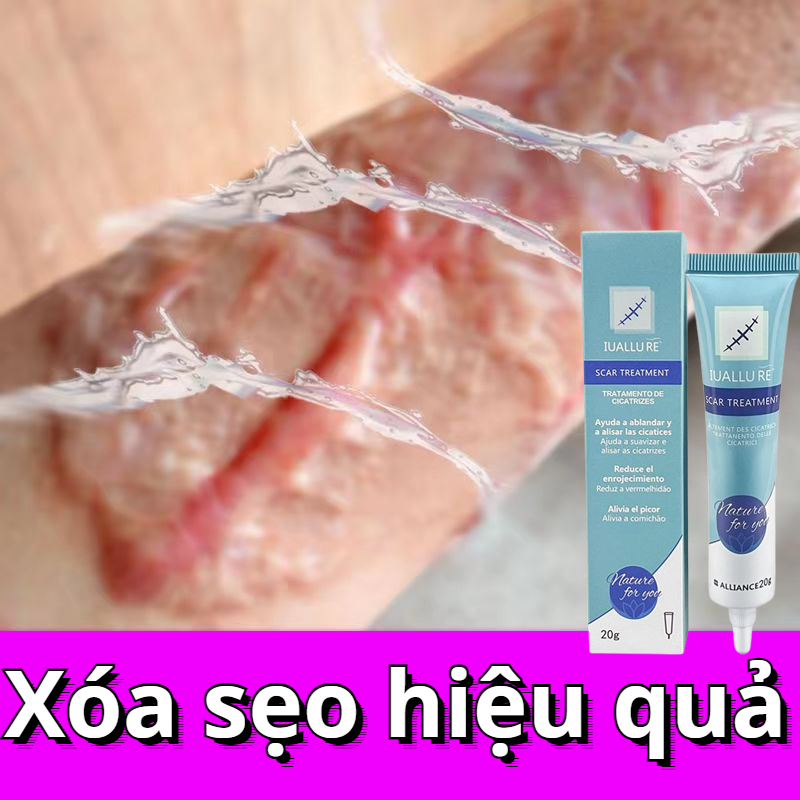 Kem Sẹo Kem Xóa Sẹo Kem dưỡng da làm mờ sẹo Xóa sẹo thâm rạn da hiệu quả Giúp phục hồi các tổn thương trên da 20g