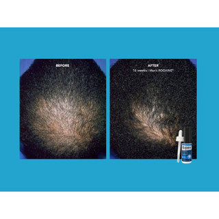 Dung dịch mọc tóc Men's Rogaine Extra Strength 5% Minoxidil Topical Solution