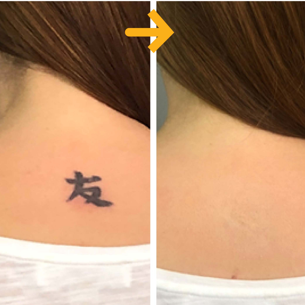 Miếng dán che hình xăm đậm màu TATUCA 3 màu da A1003