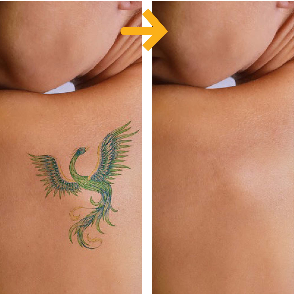 Miếng dán che hình xăm đậm màu TATUCA 3 màu da A1003