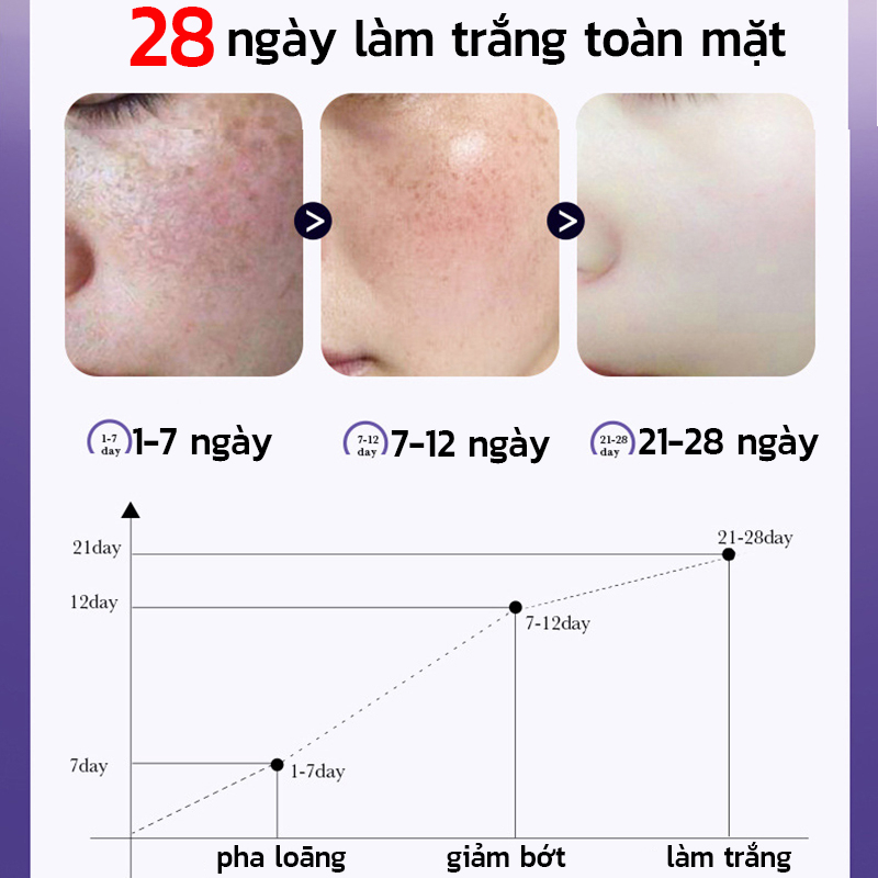 Tinh chất làm trắng xóa tàn nhang 30ml SADOER Kem làm trắng da và xóa tàn nhang, 7 ngày làm mờ vết thâm và tàn nhang