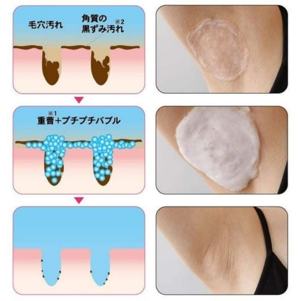 Xà Phòng ngừa thâm nách Nhật Bản Pelican Cleansing Soap For Black Spots 100g