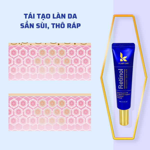 Kem retinol 0.5% K Lady Care 30ml Hàn Quốc, Giảm mụn, kiểm soát dầu nhờn, cấp ẩm, làm mờ thâm nám