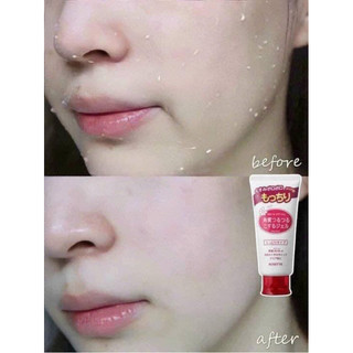 Tẩy Tế bào chết Rosette Aha của Nhật