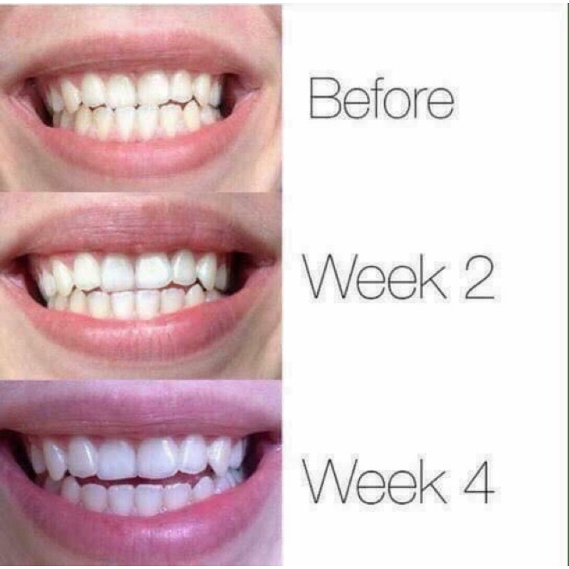 Kem Tẩy Trắng Răng  Loại Bỏ Ố Vàng Green Herbal Novolife Thái Lan