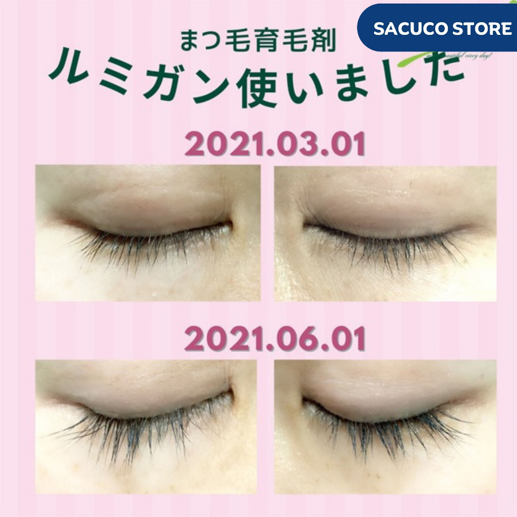 Tinh Chất dưỡng dài mi Bimatoprost