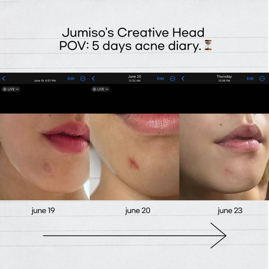 Tinh chất ốc sên peptide phục hồi da JUMISO SNAIL MUCIN 95 PEPTIDE FACIAL ESSENCE