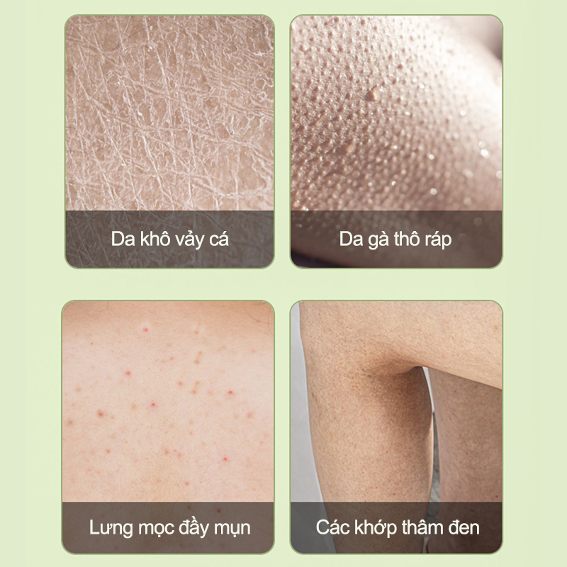 Kem tẩy tế bào chết cơ thể Tẩy tế bào chết  body da mặt 250G Loại bỏ nổi da gà và da xỉn màu