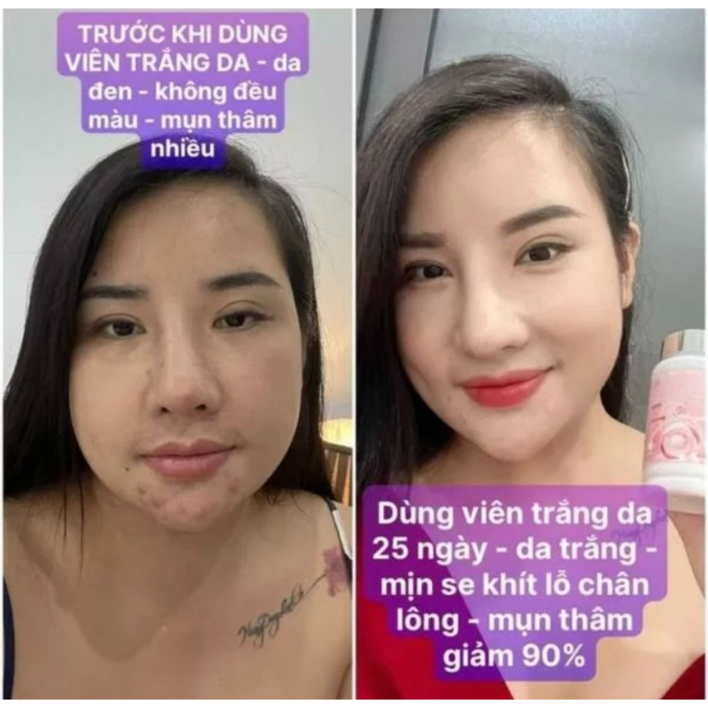 Viên ngậm trắng da hủy nám Glutathione 2500mg, viên uống chống nắng trắng da cải thiện nội tiết ngừa lão hóa lọ 60 viên