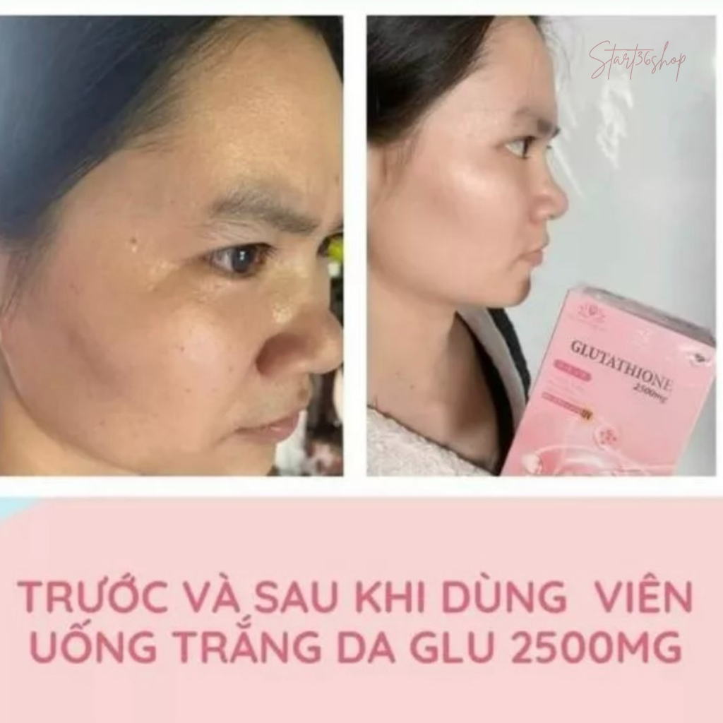 Viên uống trắng da hủy nám Glutathione 2500mg viên ngậm trắng da chống nắng cải thiện nội tiết ngừa lão hóa, lọ 60 viên