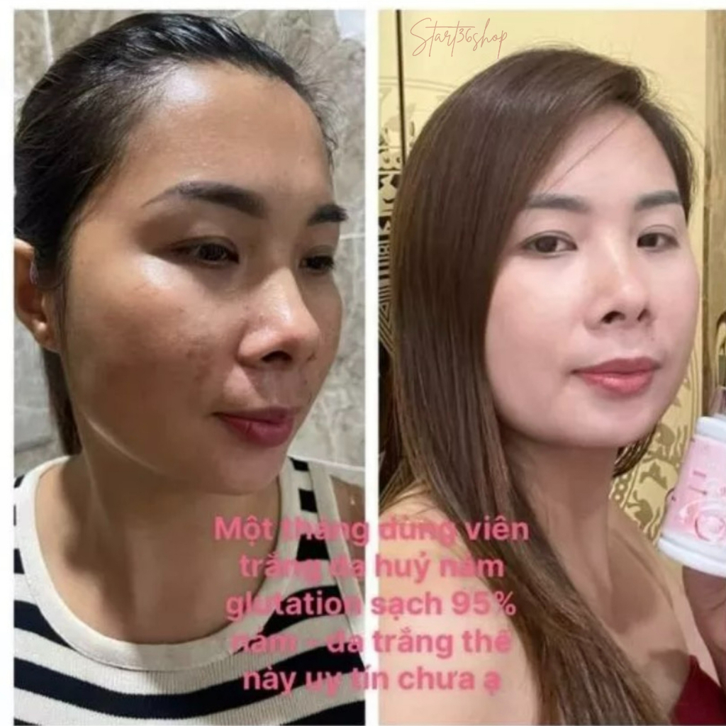 Viên uống trắng da hủy nám Glutathione 2500mg viên ngậm trắng da chống nắng cải thiện nội tiết ngừa lão hóa, lọ 60 viên