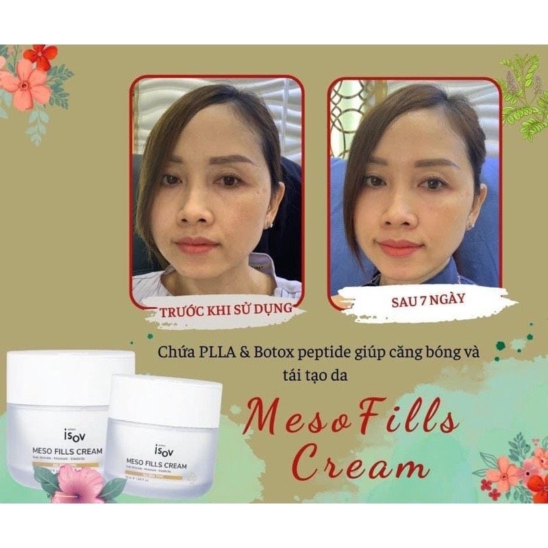 KEM MESO FILLS TÁI TẠO CĂNG BÓNG DA- Isov