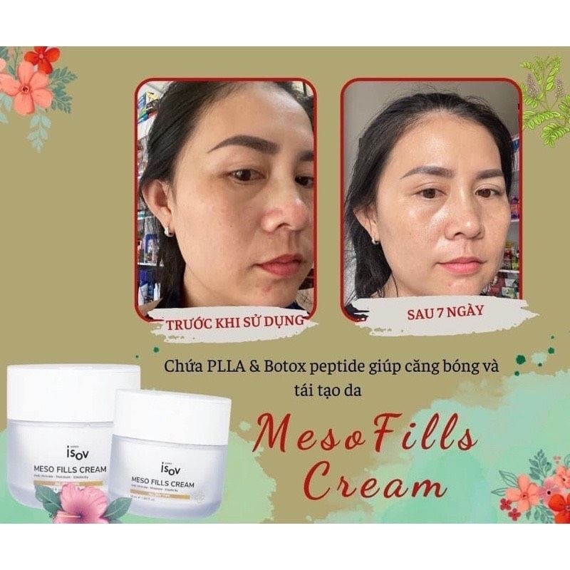 KEM MESO FILLS TÁI TẠO CĂNG BÓNG DA- Isov