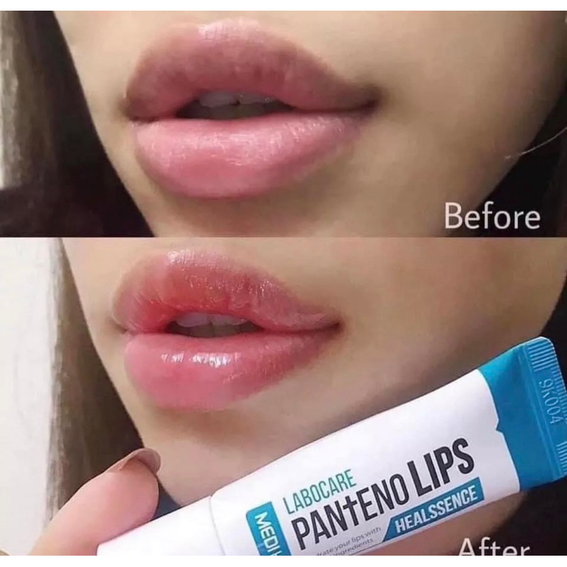 Son dưỡng môi hỗ trợ khử thâm Mediheal