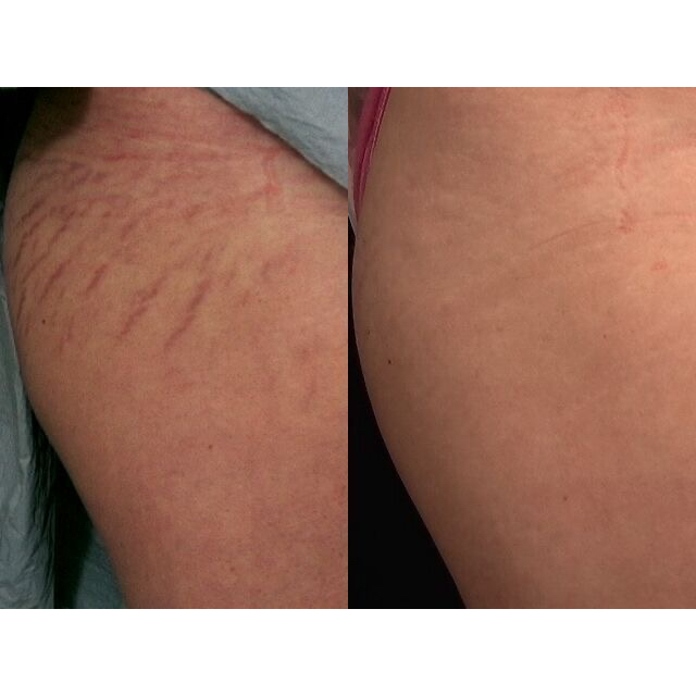 Dầu Hạnh Nhân Nguyên Chất - 100ml