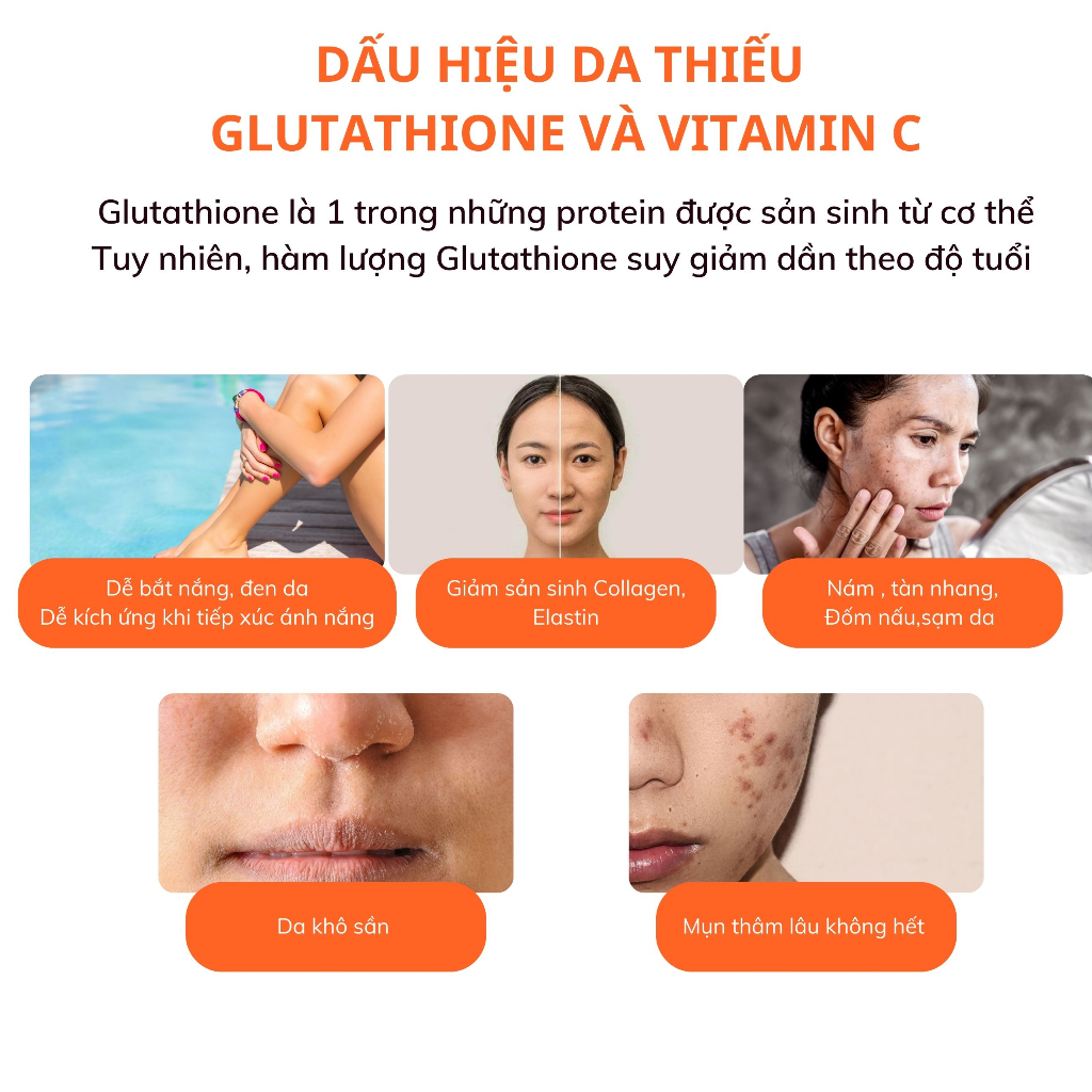 Bột uống BB LAB Glutathione 1200mg và Vitamin C 110mg làm trắng da, mờ nám, giảm thâm mụn 30 gói