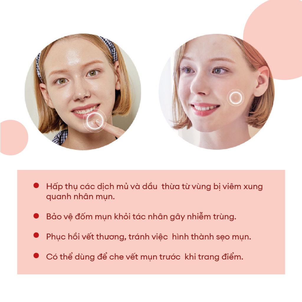 [Mã BMLTM50 giảm đến 50K đơn 99K] Combo Sạch Da  Acne Pimple Master Patch 24 Miếng + Sữa Rửa Mặt Low Ph Good Morning50ml