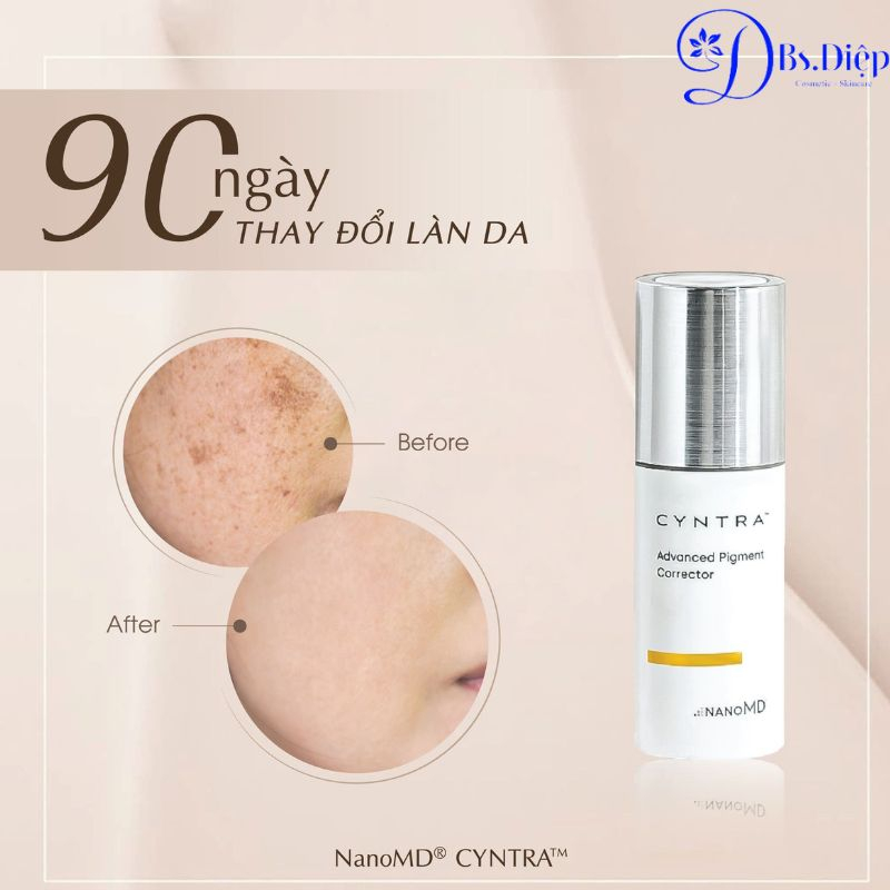 Kem làm giảm nám da nanoMD CYNTRA Advanced Pigment Corrector