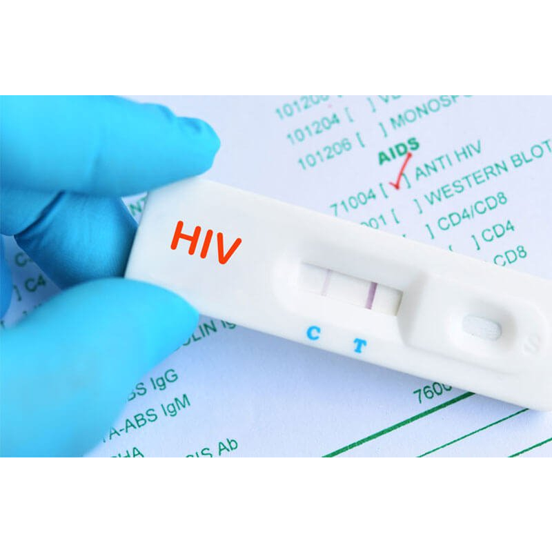 Que test thử nhanh hiv tại nhà Fastep CHE TÊN, CHÍNH HÃNG 100% MS 01