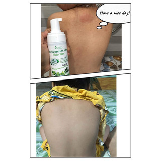 DUNG DỊCH VỆ SINH THẢO DƯỢC SÓC CON (mẫu mới)