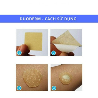 Miếng dán mụn Duoderm extra thin,miếng dán hút mủ chăm sóc da mụn (combo 1 miếng và 5kim)