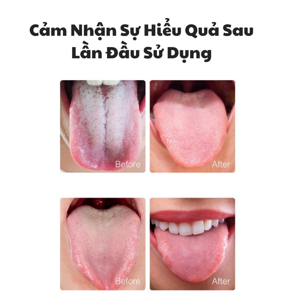 Bàn Chải Lưỡi Silicon Loại Bỏ Sạch Mảng Bám Thức Ăn Vi Khuẩn Khoang Miệng Gel Vệ Sinh Răng Miệng Hơi Thở Thơm Mát Tự Tin