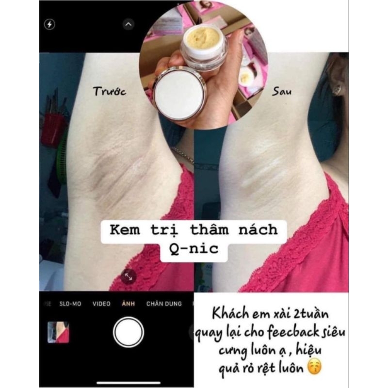 Kem Thâm Nách Qnic - Care Thái