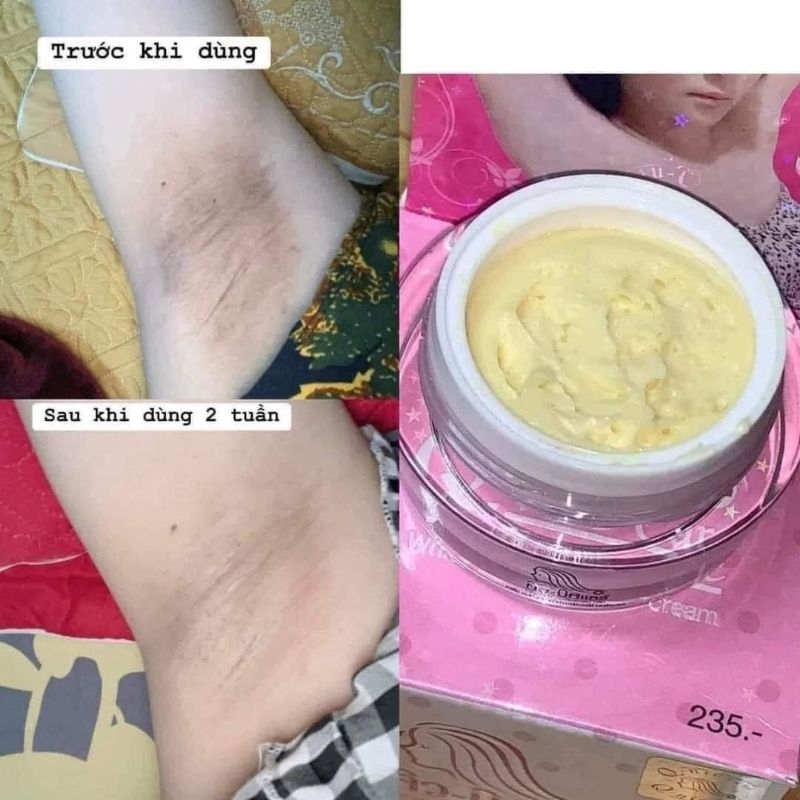 Kem Thâm Nách Qnic - Care Thái