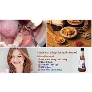 [ GIÁ GỐC ]1 CHAI SÂU RĂNG -HÔI MIỆNG DÂN TỘC DAO ĐỎ
