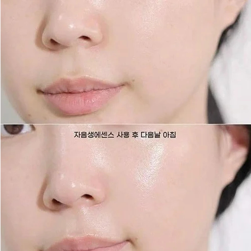 Tinh Chất Ngăn Ngừa Lão Hóa SULWHASOO First Care Activating Serum 30ml, 15ml