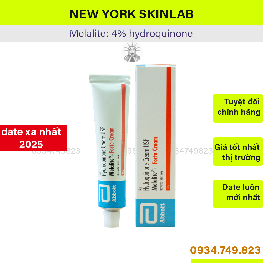 Melalite Forte Cream (30g) - 4% hydroquinone, kem giảm nám, sạm, mờ thâm của Abbott