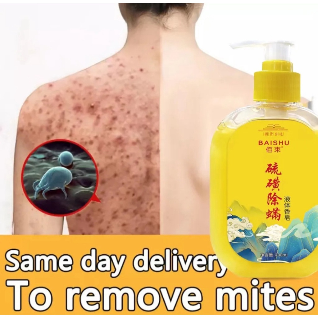 Sữa  tắm trắng da sữa tắm mụn lưng sữa tắm viêm nang lông 400ML chiết xuất 100% suối lưu huỳnh tự nhiên.